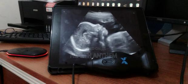 Ultrasound Portable Butterfly Iq+ and iPad