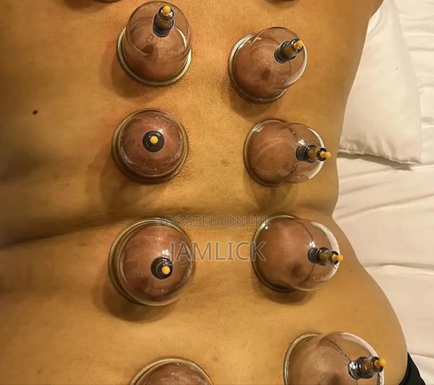 18pcs Suction Vacuum Cupping Set - Hk - thumbnail 2