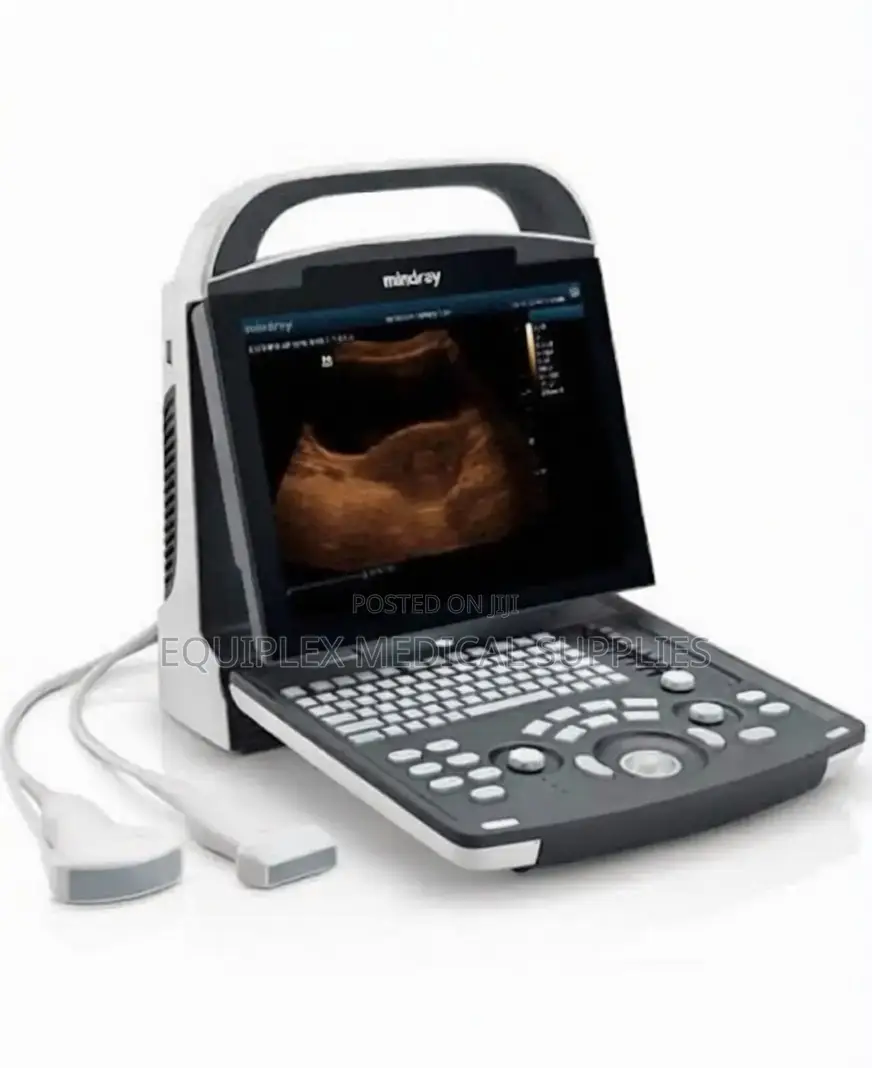 Portable Ultrasound Machine (Mindray Dp 10 Ultrasound Machine)