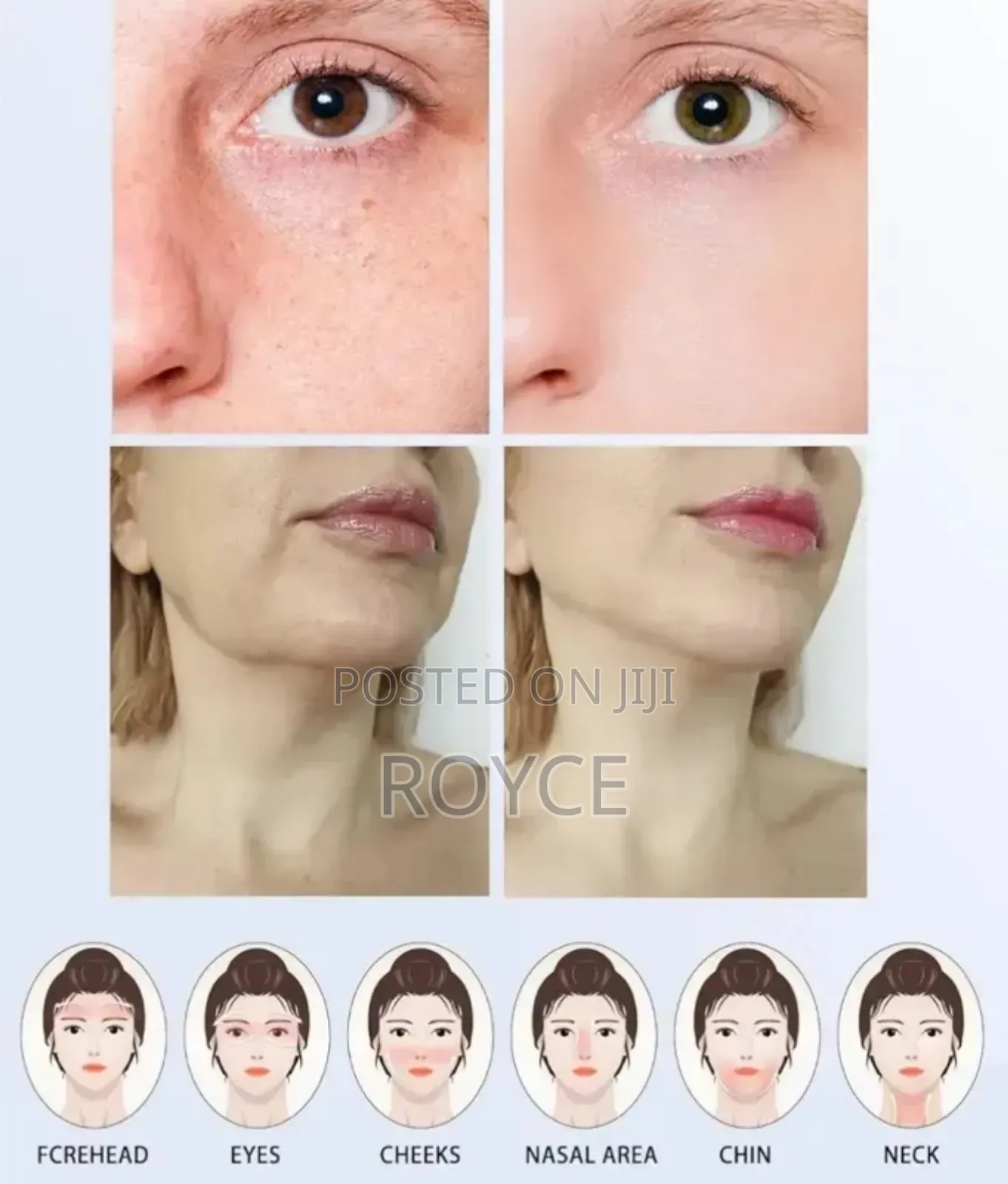 7 in 1 Facial Massager