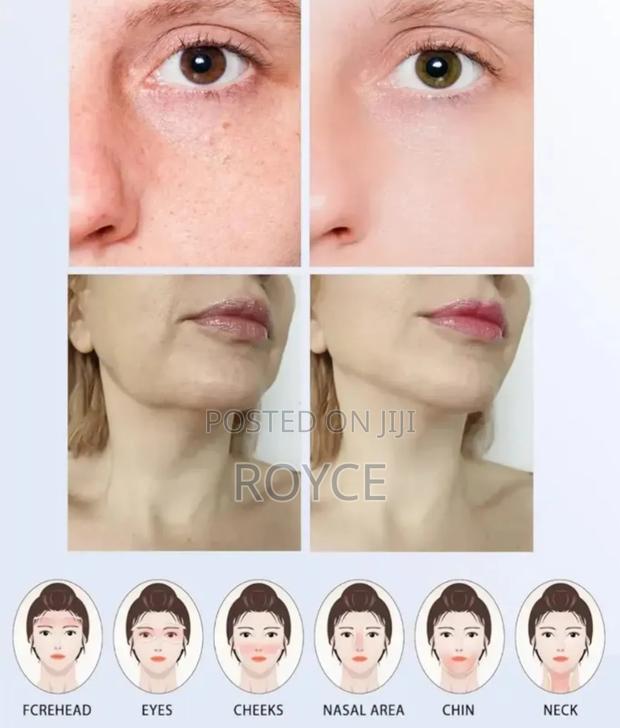 7 in 1 Facial Massager - thumbnail 2