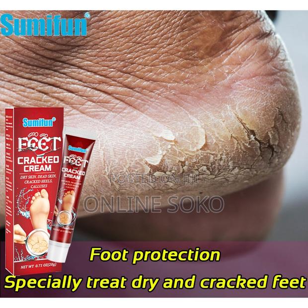 Cracked Heels Moisturizing Dry Skin Feet Repair Ointment Cream – 20g