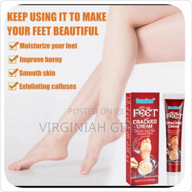 * Cracked Feet Cream