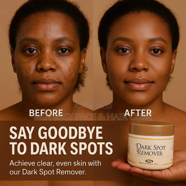 Organic Dark Spots Remover