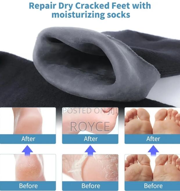 Moisturizing Gel Socks - thumbnail 5