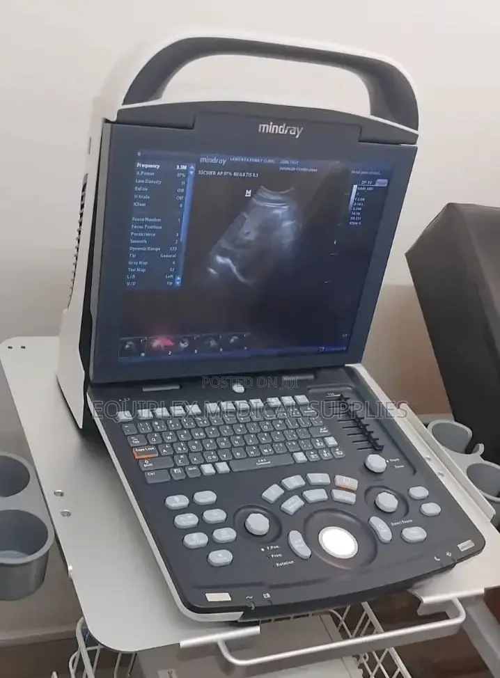Portable and Lightweight Ultrasound Machine (Mindray Dp 10)**