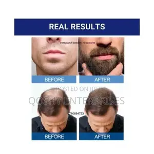 Kirkland Minoxidil 5% Hair Regrowth Treatment - 6 Bottles X 60ml