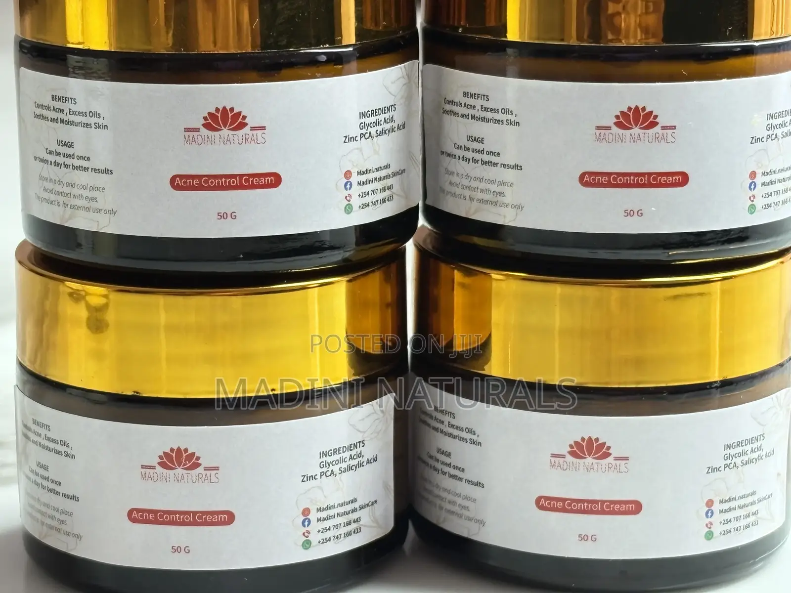 Acne Control Cream