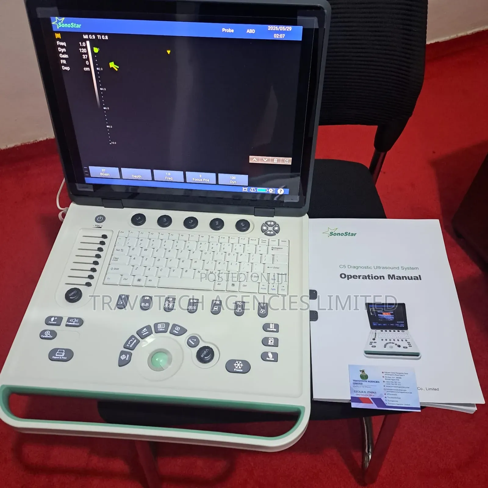 Ultrasound Color Doppler