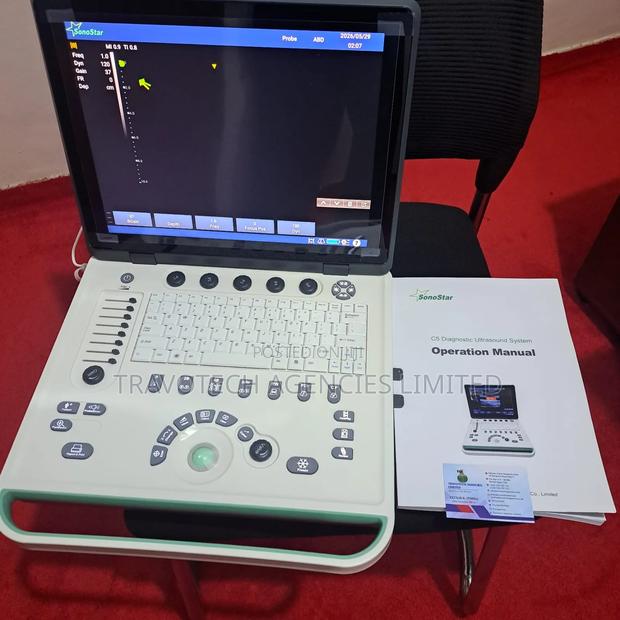 Ultrasound Color Doppler