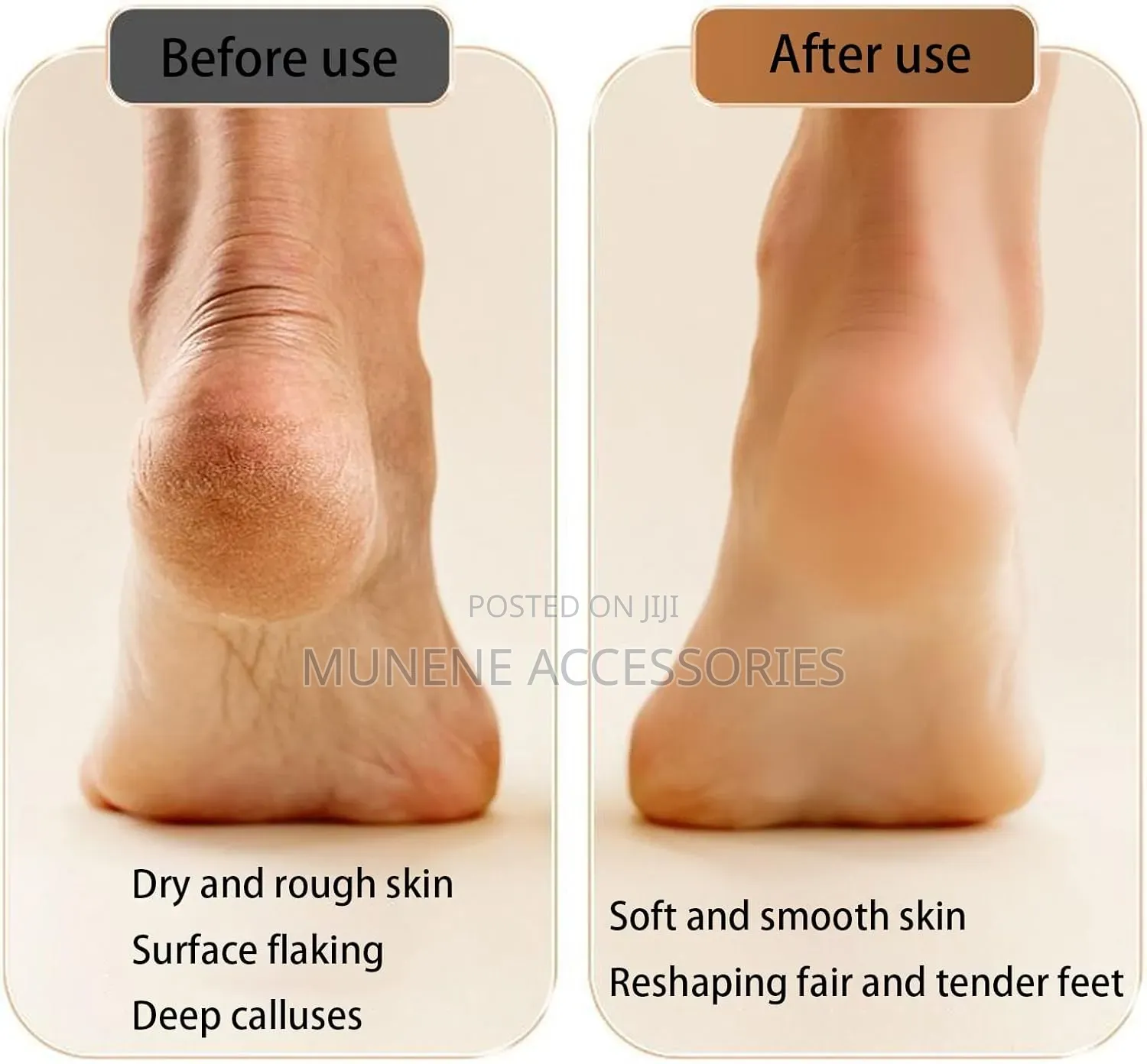 Electric Callus Foot Grinder Hard Skin Remover,Electric Foot Polisher