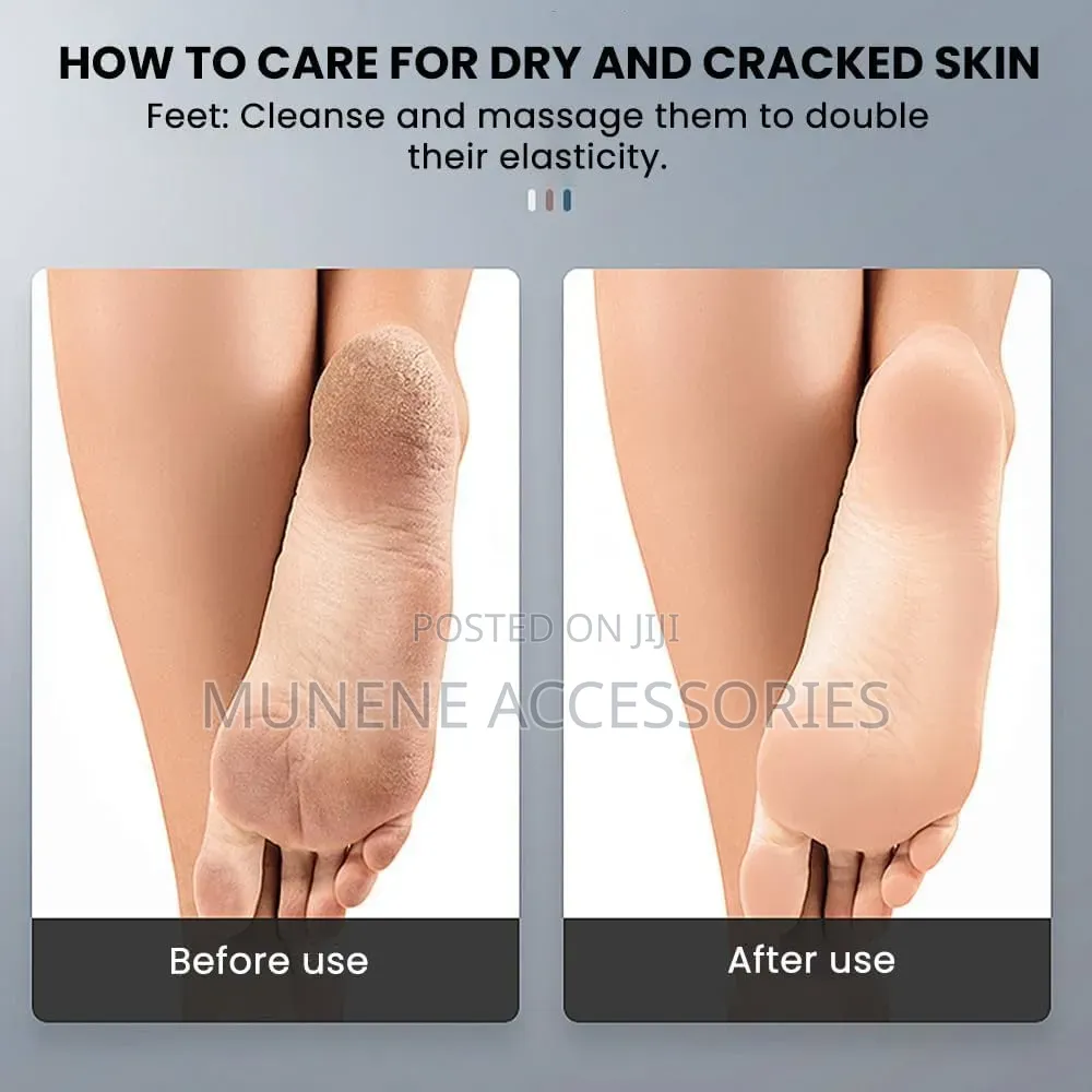 Electric Callus Foot Grinder Hard Skin Remover,Electric Foot Polisher