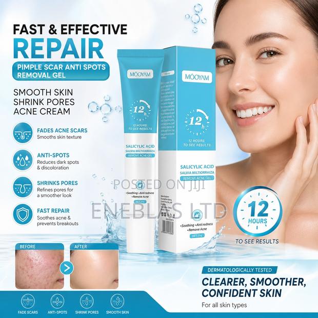 Fast Acne Scar Pimple Removal Gel –Smooth Skin Repair Cream 20g