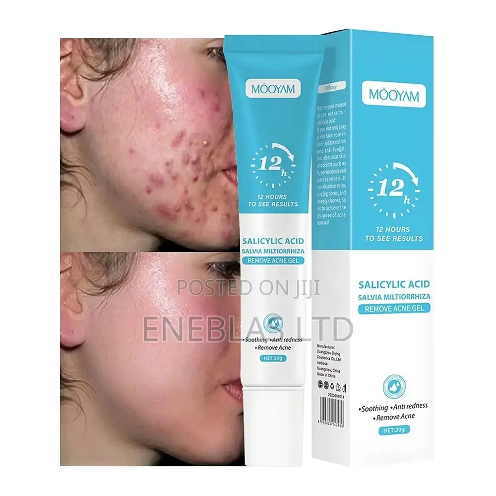Fast Acne Scar Pimple Removal Gel –Smooth Skin Repair Cream 20g