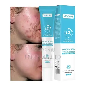 Fast Acne Scar Pimple Removal Gel –Smooth Skin Repair Cream 20g