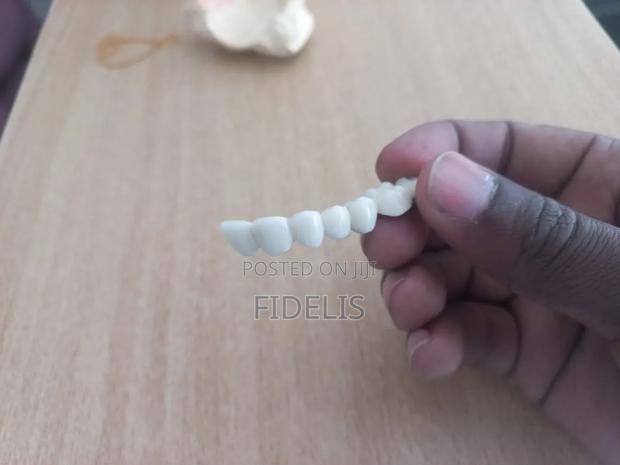 Dental Teeth - thumbnail 2