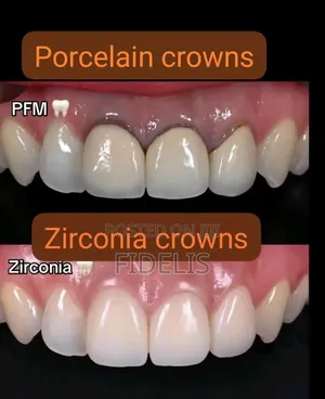 Dental Teeth