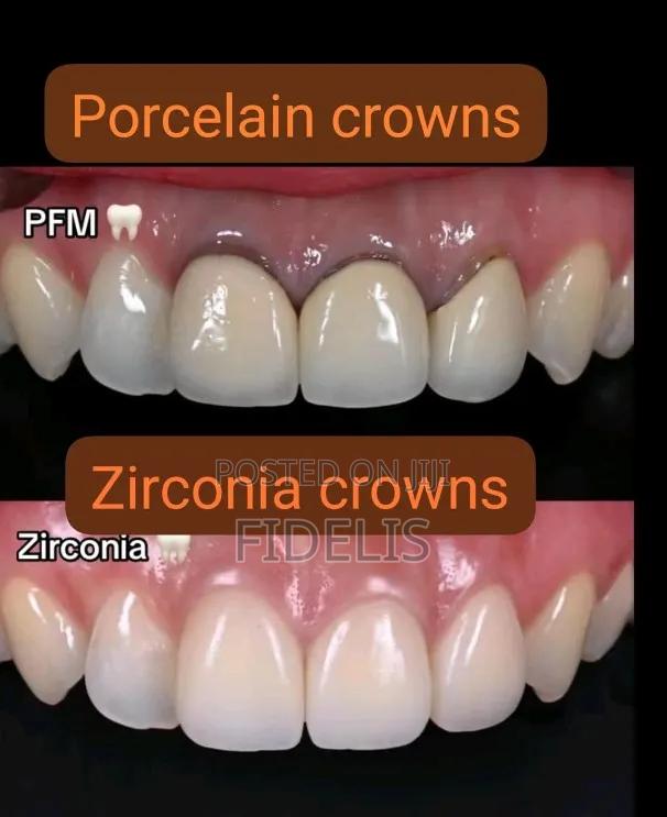 Dental Teeth - thumbnail 3