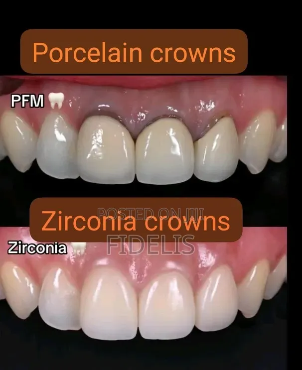 Dental Teeth