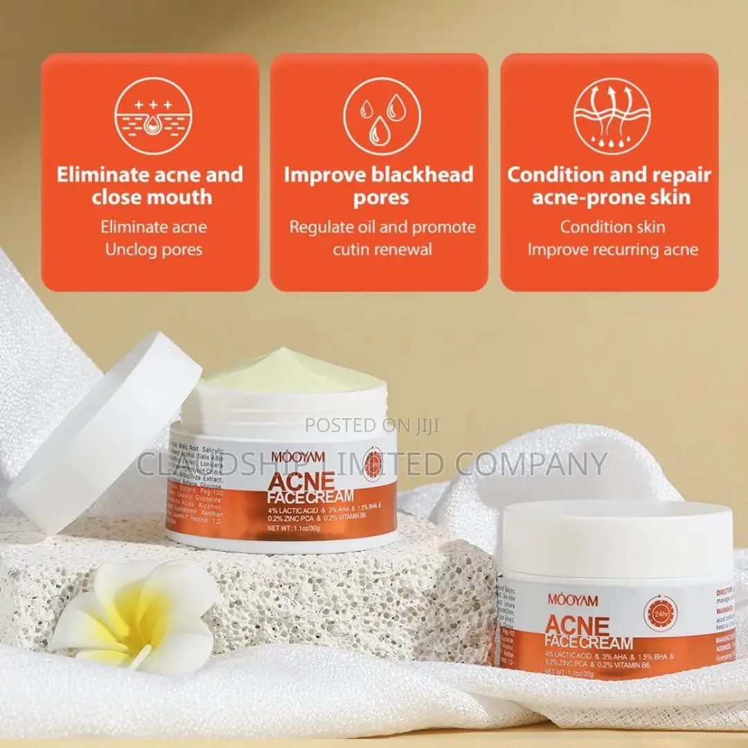 Acne Removal Face Cream