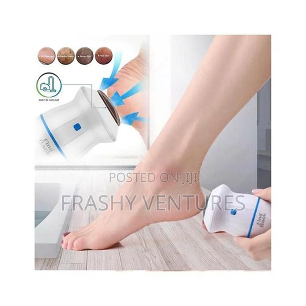 Callus Remover Foot File