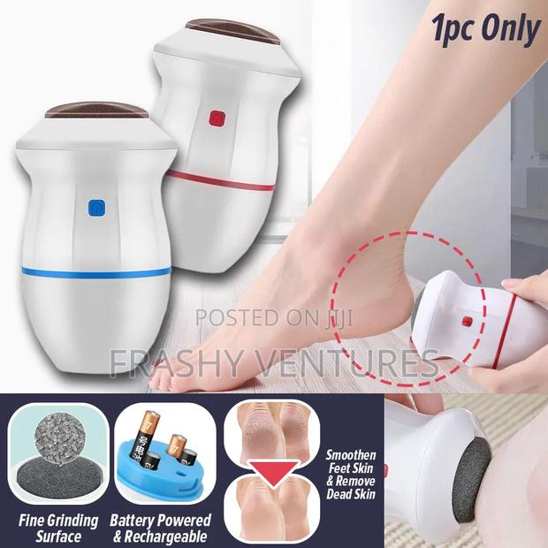 Callus Remover