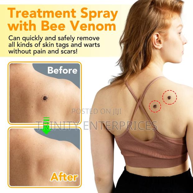 Sefudun Bee Venom Wart Remover Spray - thumbnail 3