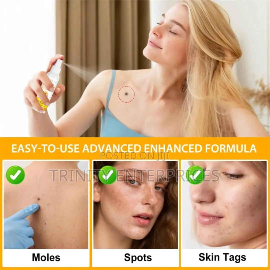 Sefudun Bee Venom Wart Remover Spray