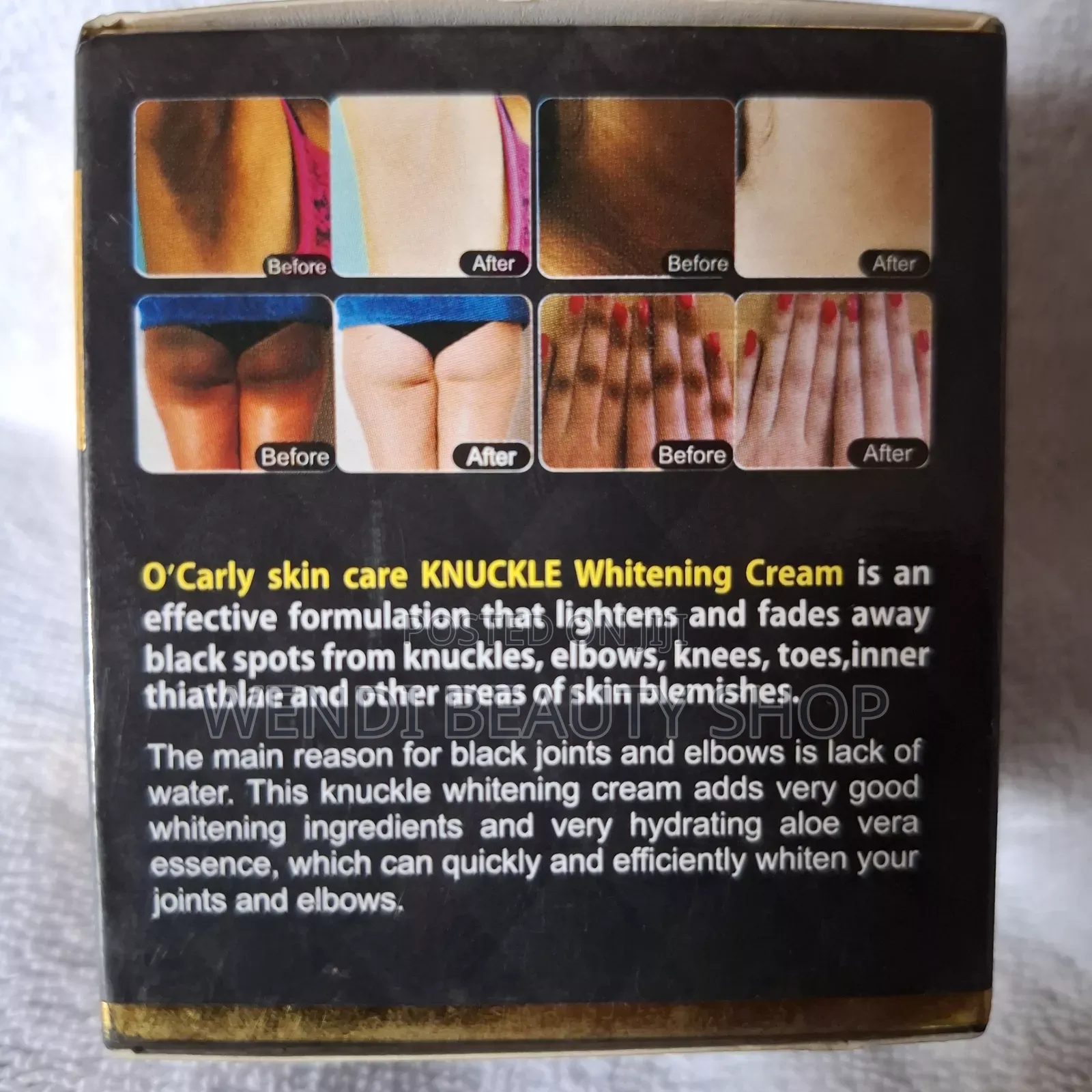Knuckle Whitening Cream