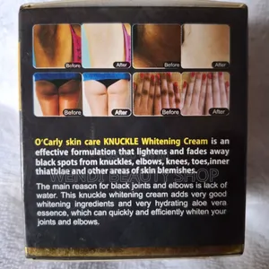 Knuckle Whitening Cream