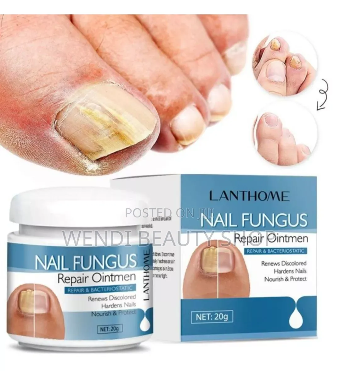 Nail Fungus Repair Ointment