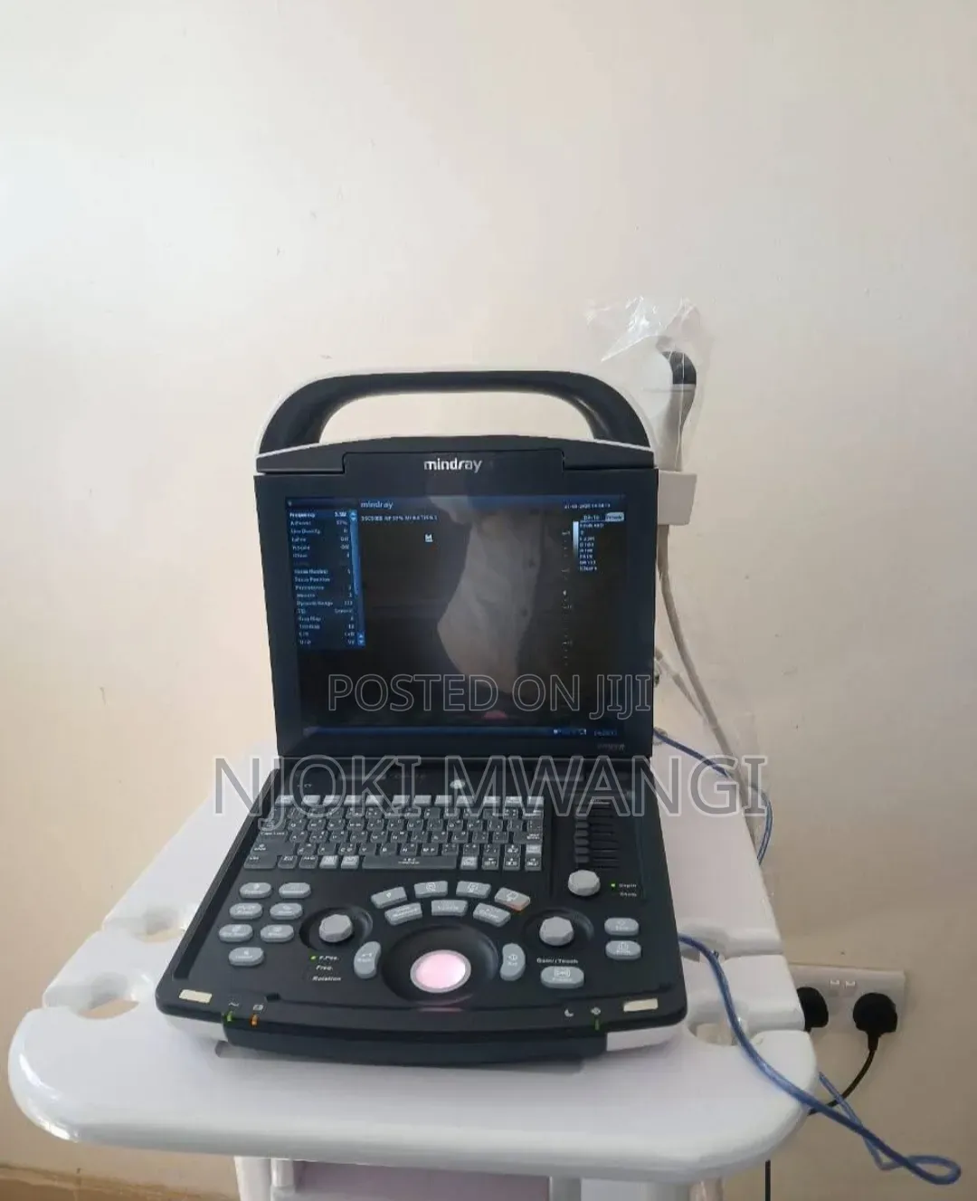 Dp 10 Ultrasound Machine (Mindray)
