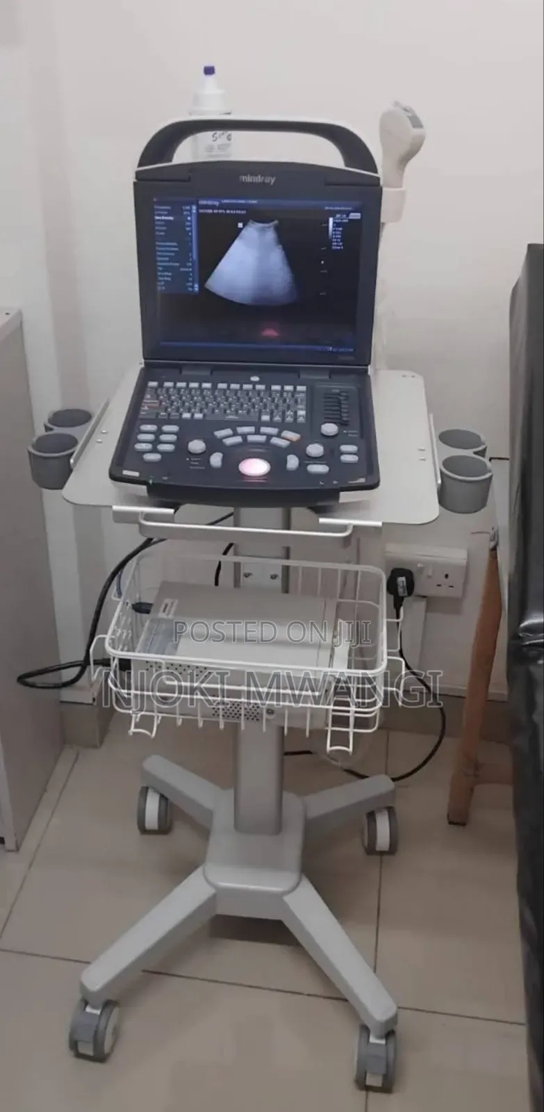 Dp 10 Ultrasound Machine (Mindray)