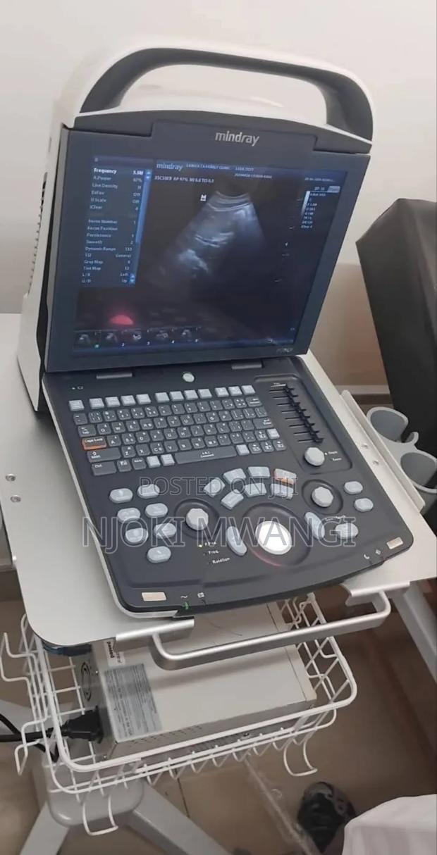 Dp 10 Ultrasound Machine (Mindray) - thumbnail 3