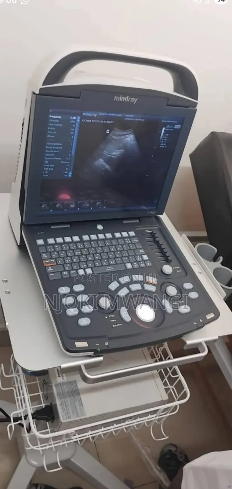 Dp 10 Ultrasound Machine (Mindray)