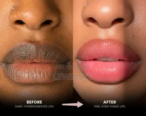 Dark Lips to Pink Lips Solution