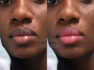 From Dark Lips to Pink,Soft and Yummy Lips