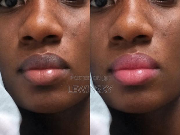 From Dark Lips to Pink,Soft and Yummy Lips