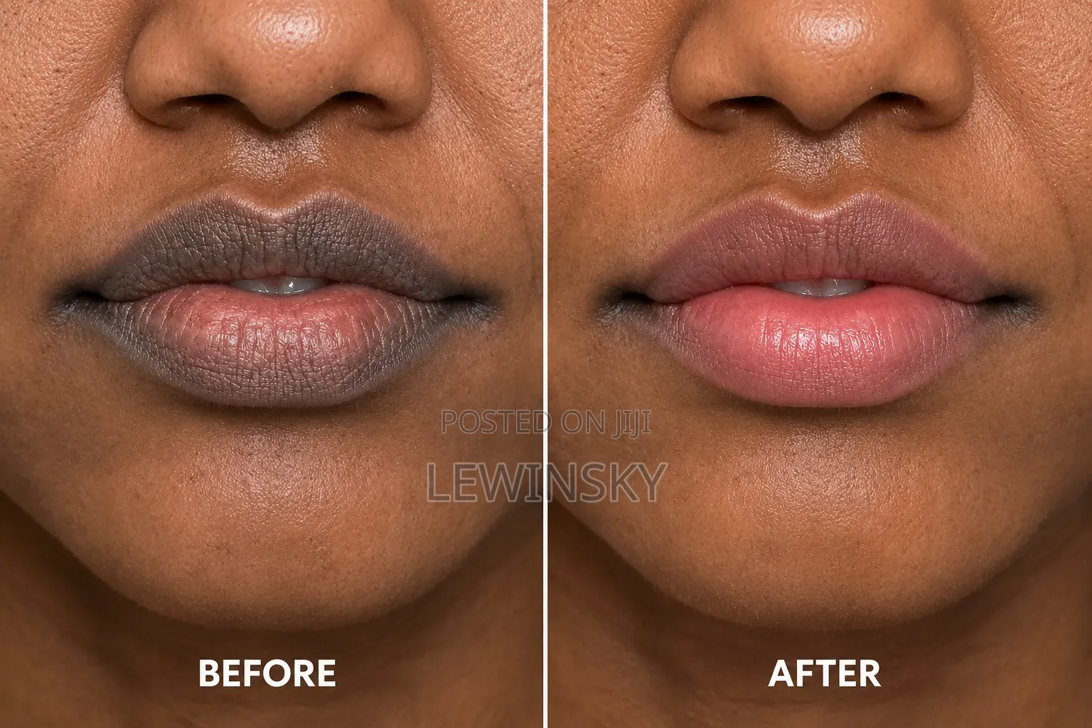 From Dark Lips to Pink Yummy Lips