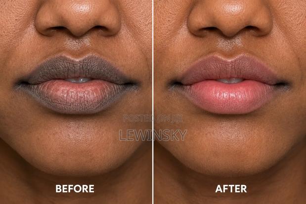 From Dark Lips to Pink Yummy Lips