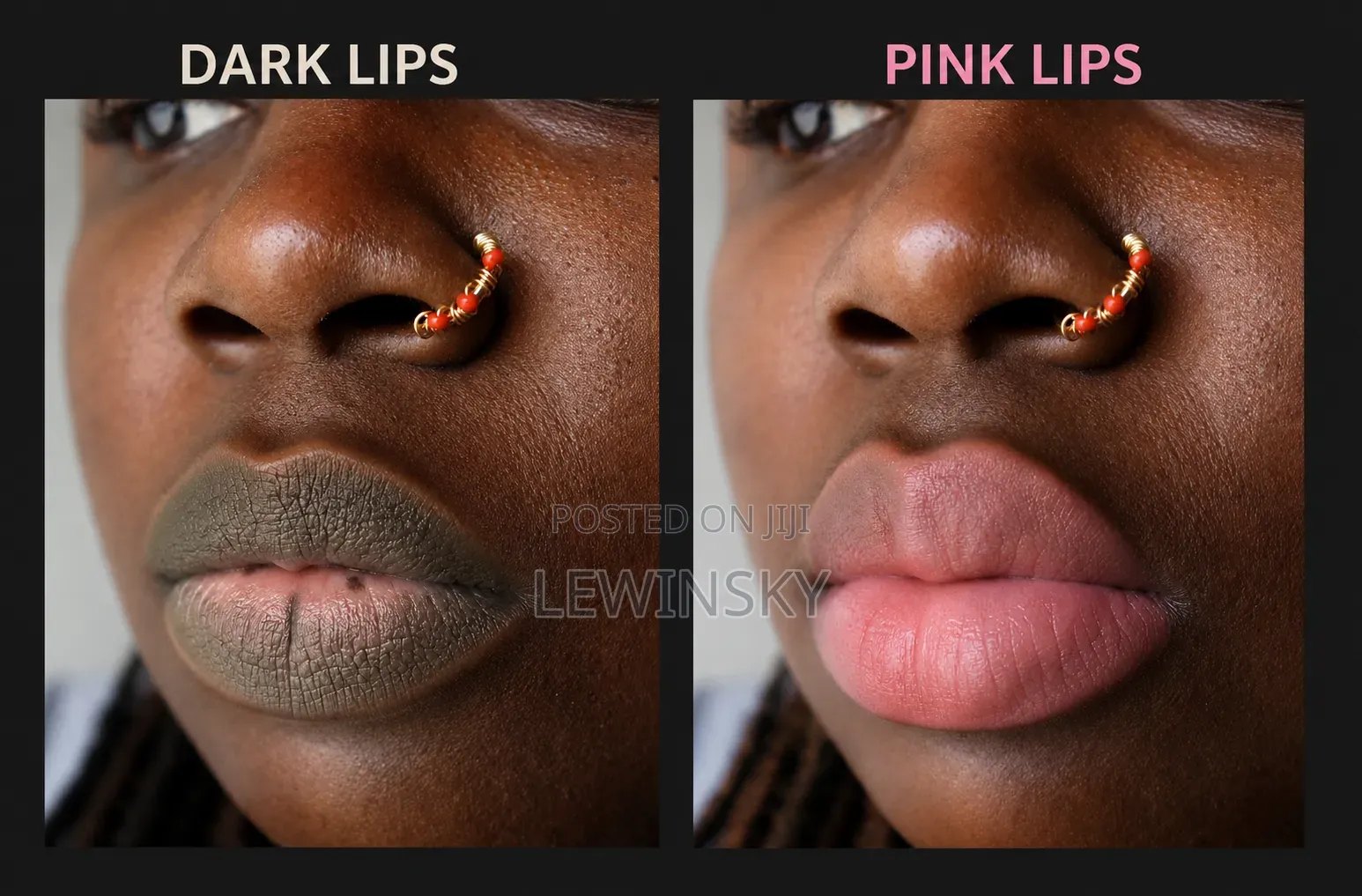 Dark Lips to Pink Lips Therapy