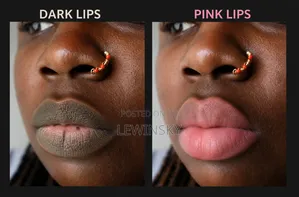 Dark Lips to Pink Lips Therapy