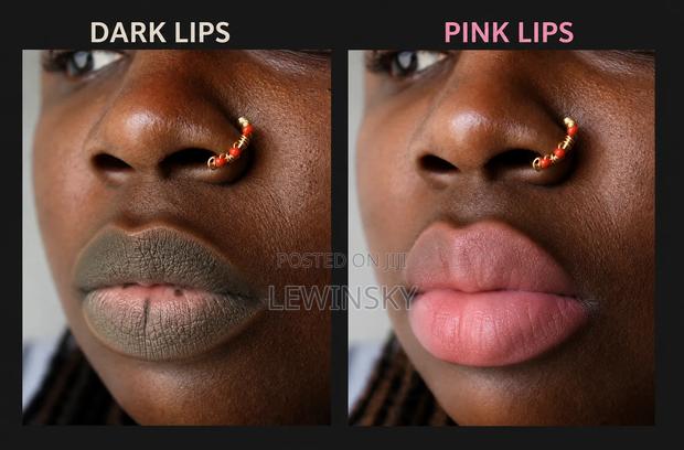 Dark Lips to Pink Lips Therapy