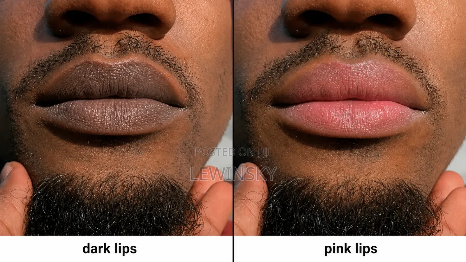 Our Famous Pink Lip Therapy