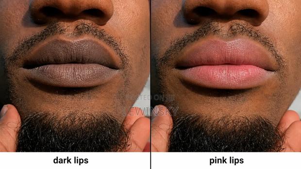 Our Famous Pink Lip Therapy