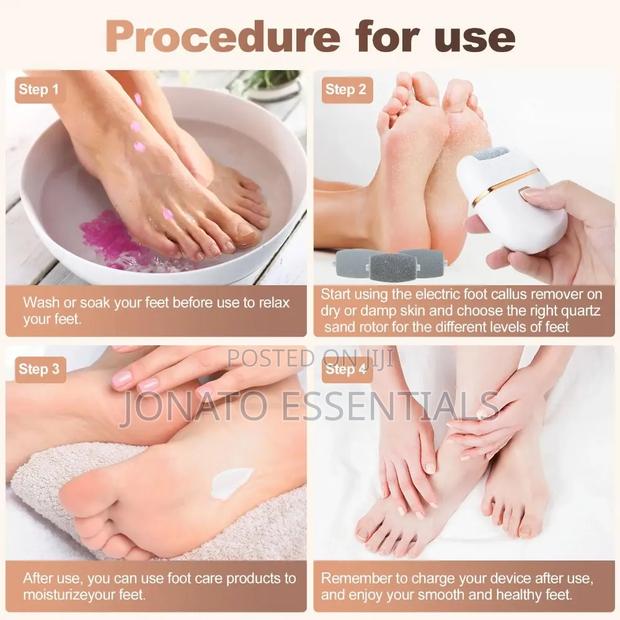 Electric Foot File Callus Remover - Rechargeable Pedicure Tool - thumbnail 2