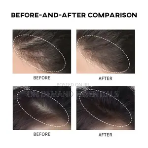 Hair Line Dye Powder Black Brown, Root Cover Up