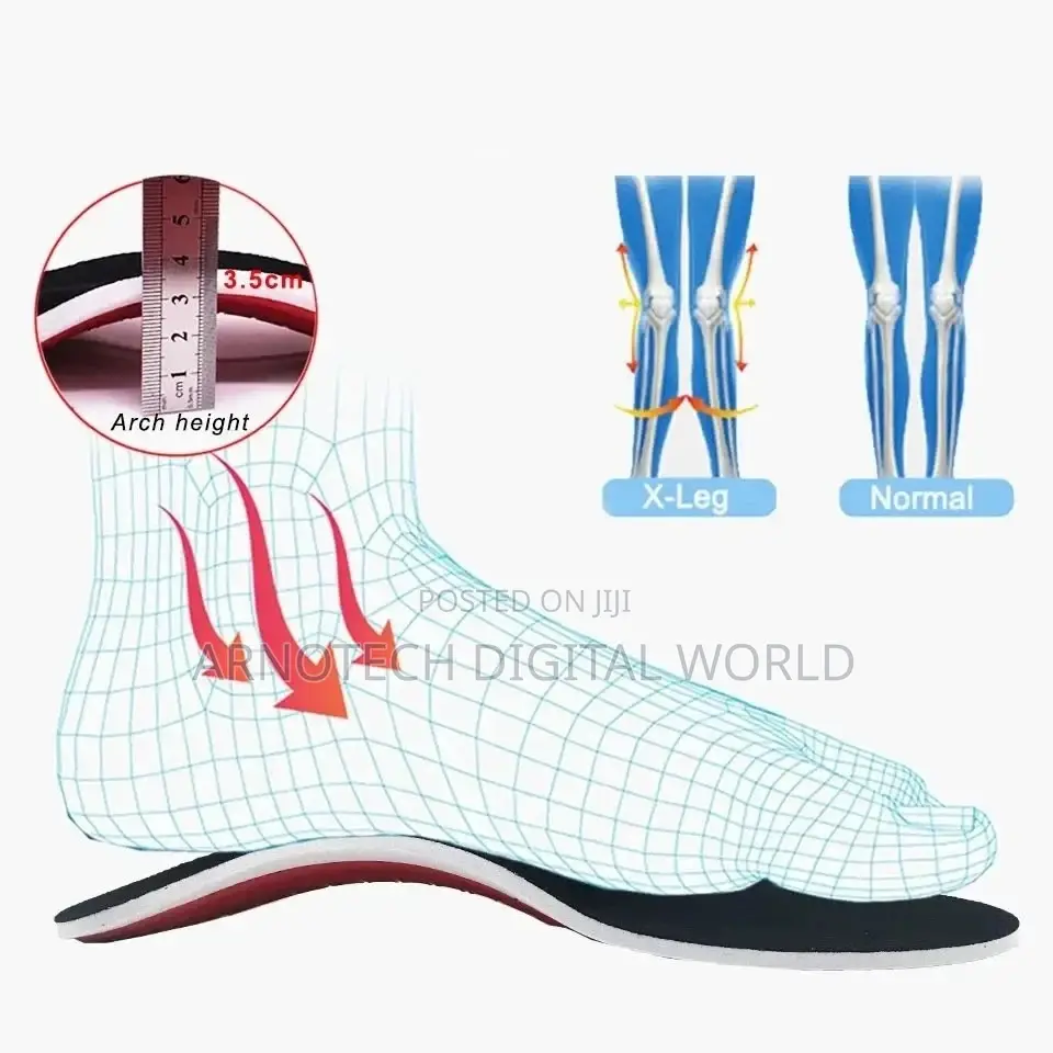 Orthopedic Insoles, OrthoSole Flat Foot Correction,Pain Relief Insoles