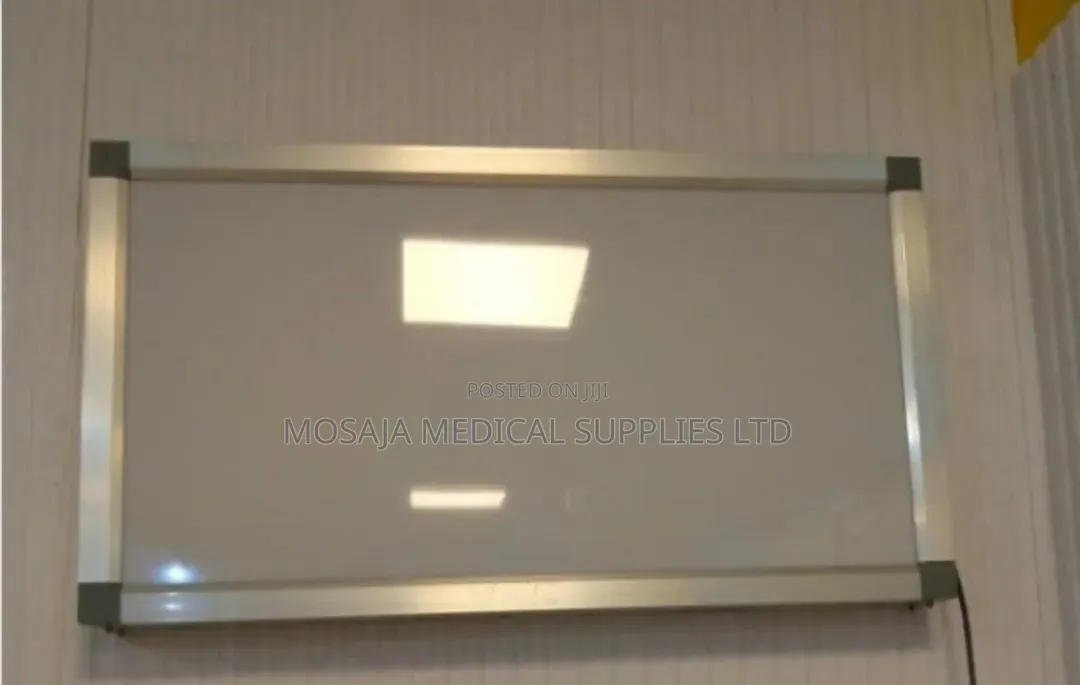 X Ray Viewer Double