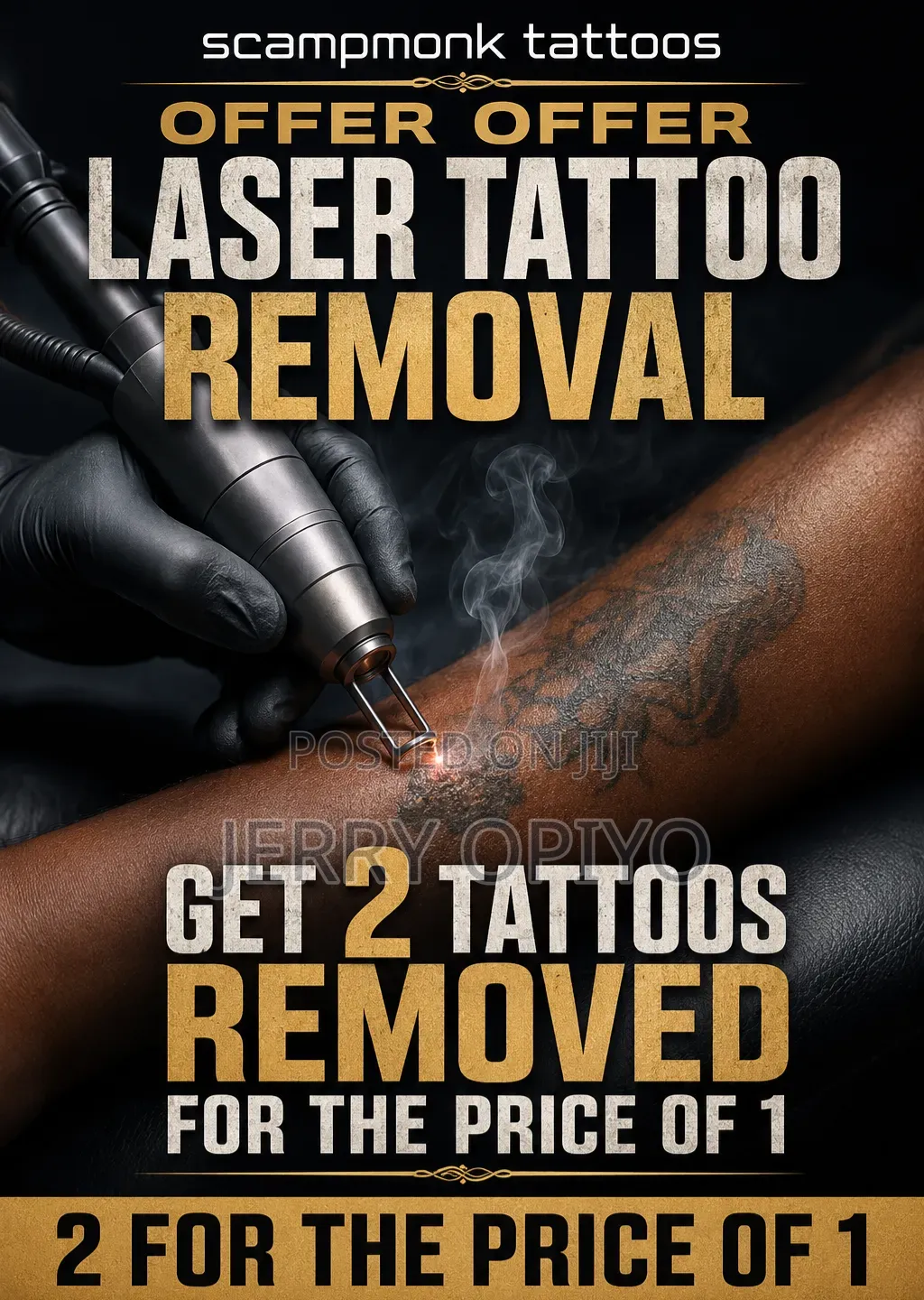 Laser Tattoo Removal